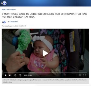 Screenshot of an article titled: 6-month-old baby to undergo surgery for birthmark that has put her eyesight at risk